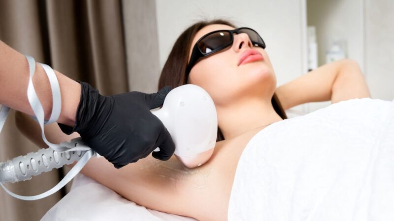Prep Tips for Winter Laser Hair Removal in Toronto